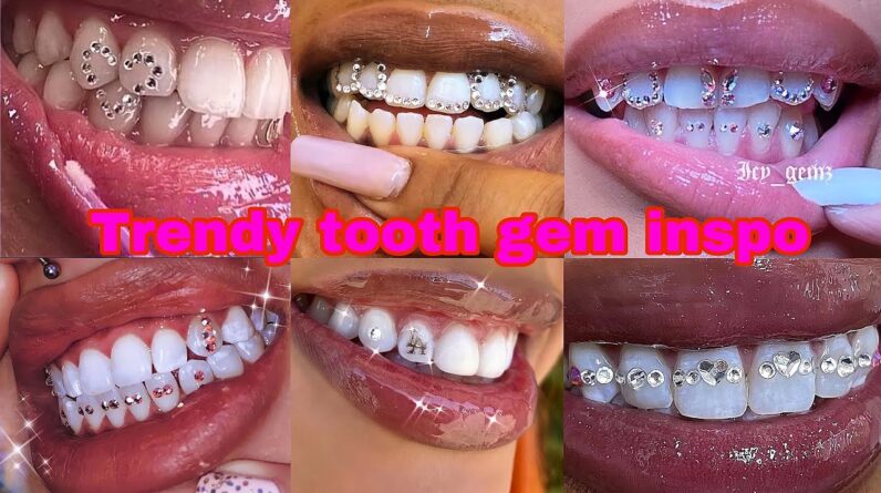 ☆ Trendy Tooth gems inspo Compilation 2022☆👄